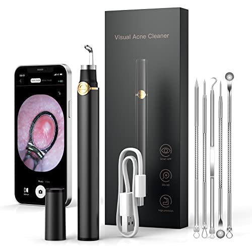 Top 10 Best Blackhead Extraction 2023 Reviews