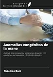 Anomalías congénitas de la mano: Fallo de diferenciación o separación de partes con afectación del esqueleto y los tejidos blandos (Spanish Edition)
