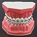 Dental Orthodontic Model Teeth Treatment Model with Metal Bracket Archs Tubes Ligature Ties for Teaching Studying Standard Size