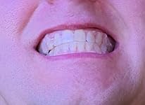 Review Image by Raponator Raponator