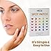 Acne Care Pimple Patch - 8 - Cheek Size Acne Spot Treatment Hydrocolloid Bandage Absorbing Cover for Face Skin Acne Spot Patch Conceals, Reduces Pimples and Blackheads