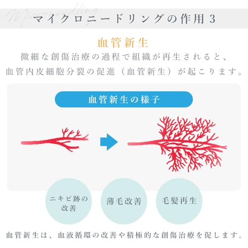 Yeamon ダーマローラー Derma novaフェイスローラー (銀0.5mm) の商品画像 6