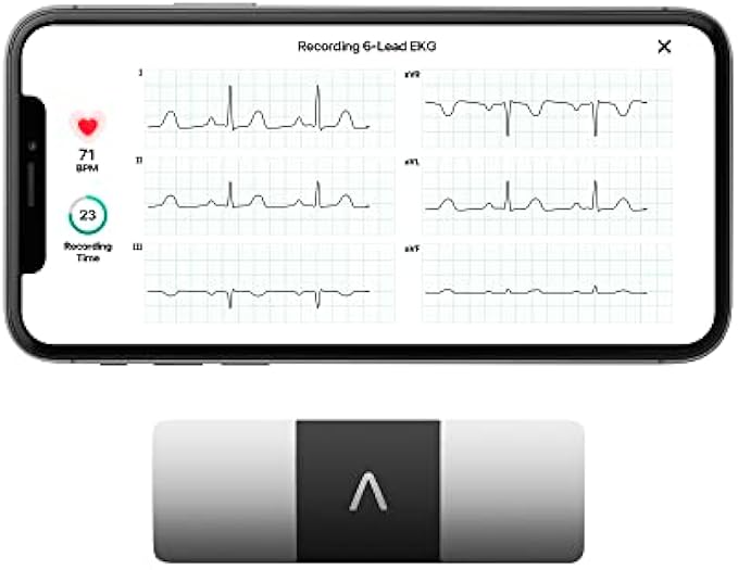 KardiaMobile 6-Lead Personal EKG Monitor – Six Views of The Heart – Detects AFib and Irregular Arrhythmias – Instant Results in 30 Seconds – Works with Most Smartphones - FSA/HSA Eligible
