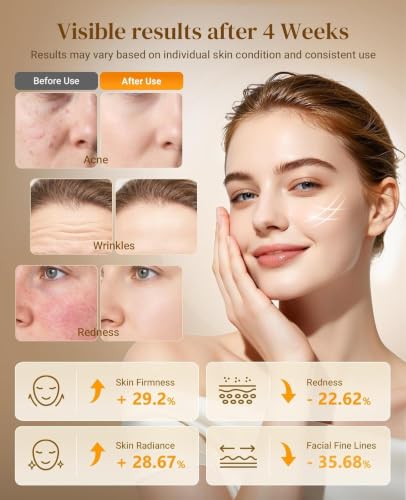 Lanieney Wireless LED Red Light Therapy Face Mask - 39.99 w/ Code + 69% Off Code Q2FVMI98 - image 2