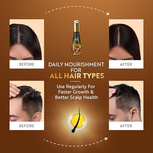 Image of Aura 18 Herbs Hair Oil for Hair Growth & Hair Fall Control Enriched with Amla, Bhringraj & Neem Lightweight, Non-Sticky & Natural Herbal Oil for Men & Women,120 ml