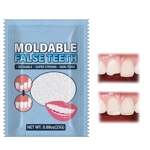 Kit de Reparación de Dientes Temporal, Dientes Falsos Moldeables Temporales,Reparación de Dientes,Empaste Provisional Dental,para Reparar el Relleno del Diente Roto Faltante,25g
