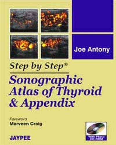 Step by Step: Sonographic Atlas of Thyroid and Appendix : Buy Online at ...