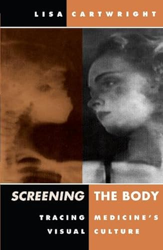 Screening The Body: Tracing Medicine’s Visual Culture