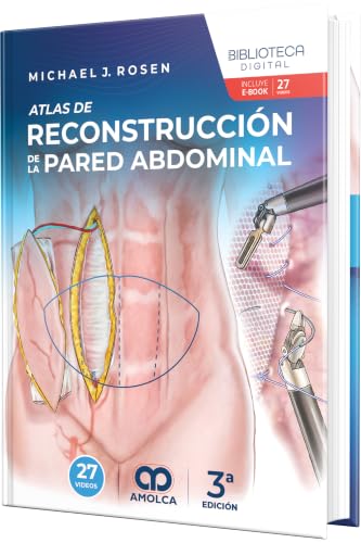 Atlas de reconstrucción de la pared abdominal