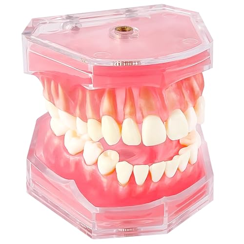Ceonam Removable Teeth Model