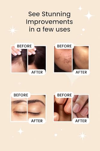 Image of Murli Castor Oil (Arandi ka Tel) | 100% Pure & Natural Oil for Hair Growth, Eyelashes, Eyebrows, Skin, Scalp, Nails, Acne Scars, Pigmentation & Lip Care | Rich in Vitamin E (400 ml)