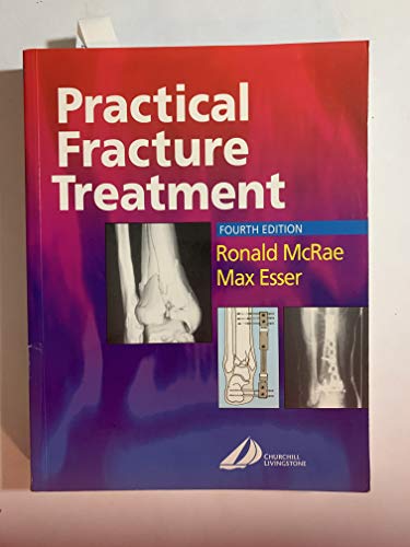 Practical Fracture Treatment, 4th Edition