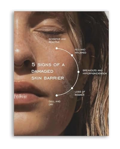 Affiche barrière cutanée 40x60cm encadrée pour cabinet dermatologie