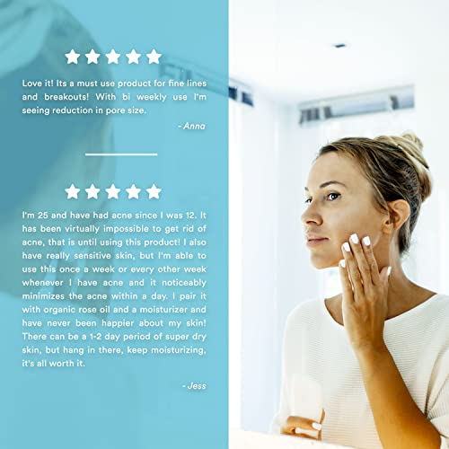 Glycolic Acid 50% Gel Peel - Enhanced With Retinol & Green Tea Extract (Professional Skin Peel)1 Ounce #TOP4