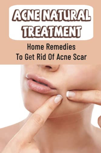 Acne Natural Treatment: Home Remedies To Get Rid Of Acne Scar