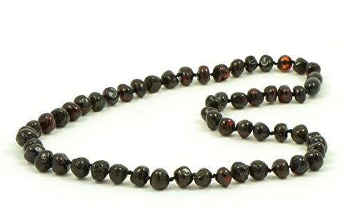 TheNaturalAmber Baltic Amber Necklace for Adults – Genuine Polished Cherry Baroque Beads, Pain & Anxiety Relief, Healing Jewelry, 55cm3