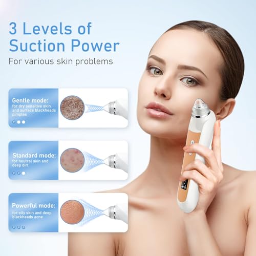 Image of Facial Pore Blackhead Remover Vacuum
