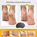 BEZOX Nano-Glass Pumice Stone for Feet Dead Skin, Eco-Friendly Pedicure Foot File Callus Remover - Bamboo Handle