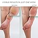 Hey Honey Walk the Walk Propolis Foot & Heel Cream for Dry, Cracked Feet | 72-Hour Hydration, Callus Remover & Odor-Fighting Moisturizer with Honey & Urea | 5 oz