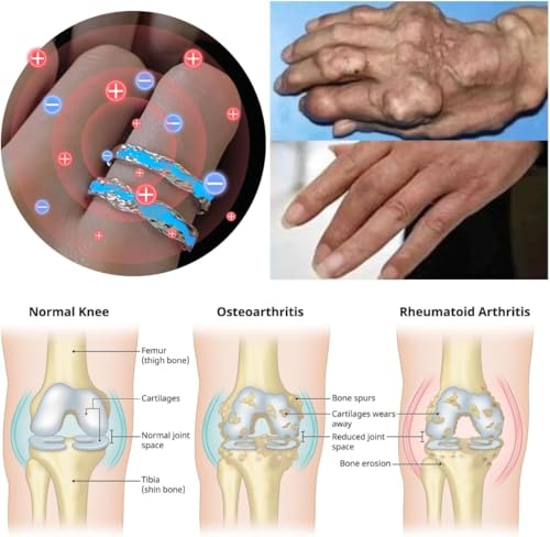 Lymphatic Magtherapy Luminous Ring For Men Women, Titanium Ion Therapy Acupuncture Unclog Bloodstream Lymph Nodes Light Up Hope Adjustable Finger Ring Jewelry Gift For Couple3