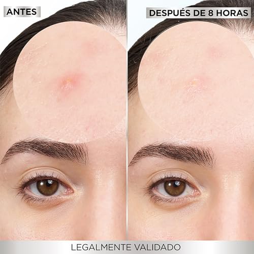 La mejor selección de Mascarilla aclaradora - los más vendidos. 12 Imagen adicional