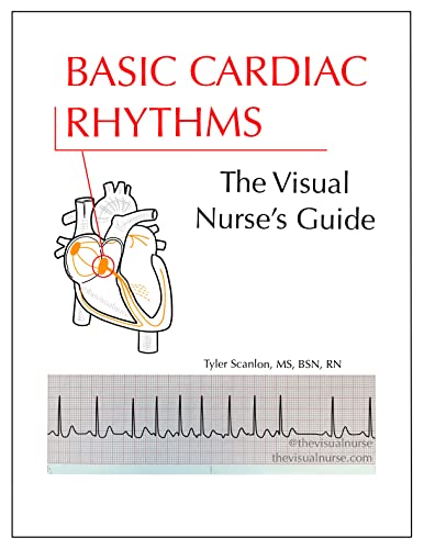Basic Cardiac Rhythms: The Visual Nurse's Guide