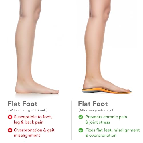Image of FOVERA Rigid Arch Support Insole for Flat Feet - Orthotic Shoe Inserts for Plantar Fasciitis, Heel Spurs, High Arch, Foot Pain & Enhanced Stability, Trimmable Shoe Soles (XS, Women's 5-6.5 UK)