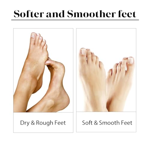 LuxaDerme Foot Hydrating Socks | Deeply Moisturizes Dry & Dull Skin | Even Tones Skin | Nourishes Nails & Cuticles (Pack of 1) - Image 7