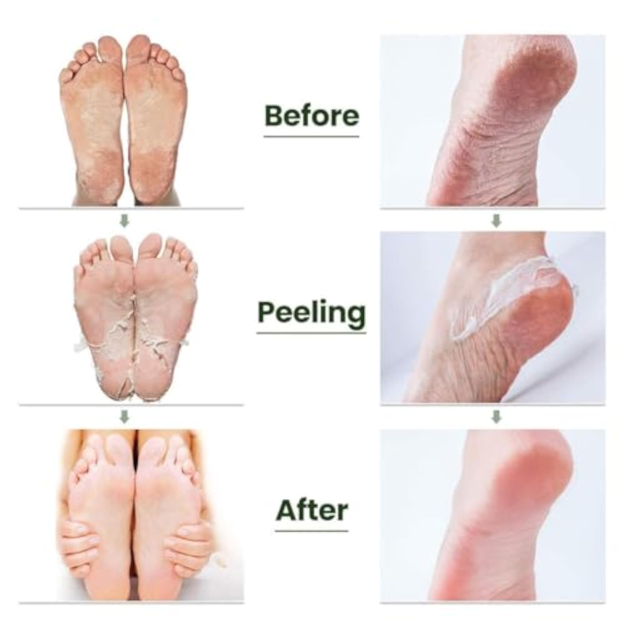 Nirviklpe Exfoliating Foot Mask for Soft and Smooth Feet