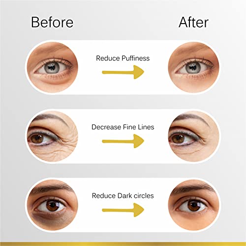 Zuke Under Eye Patch - 5 Pairs | 24k Gold With Vegan Collagen for Dark Circles & Puffy Eyes | Treats Wrinkles & Fine Lines | Enriched With Rosemary & Hyaluronic Acid - Image 6