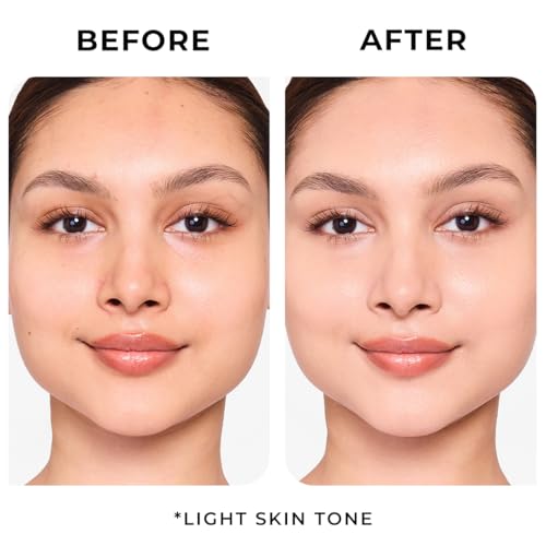 A visual representation of dry, peeling skin needing deep barrier repair.