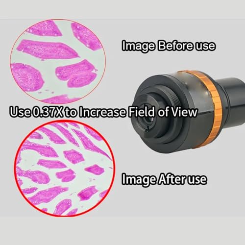 Ocular de microscopio eléctrico regulable con interfaz de cámara y campo ampliado 5