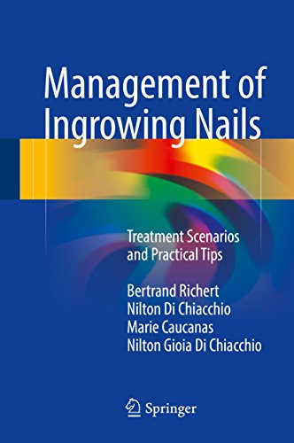 Management of Ingrowing Nails: Treatment Scenarios...