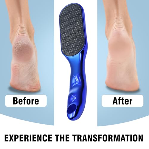 2 Pcs Veinsgrain Foot File, Nano Glass Foot File Hard Skin Remover with Non-Slip Ergonomic Handle, Professional Foot Care Tools for Smooth Feet(Gold+Blue) - Image 4