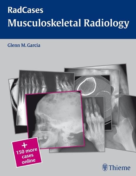 Buy Musculoskeletal Radiology: RadCases — BookShops.in