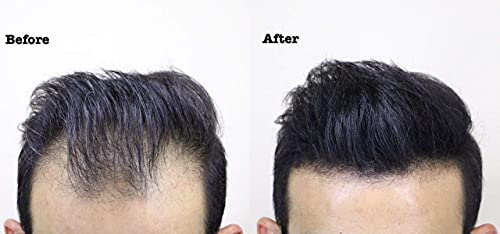 Thick Fiber TF-VARIATIONS Hair Fibers For Thinning Hair & Bald Spots thumb #6
