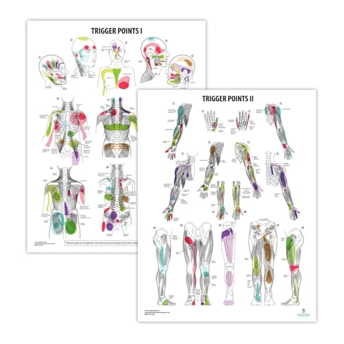 Trigger Points I and II Laminated Chart/Posters : Industrial & Scientific