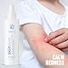 BRIOTECH Babies & Kids Skin Love, Soothing Hypochlorous Acid Spray, Pure HOCl for Sensitive Skin, Calm Redness & Bumps, Support Against Diaper Irritation, Gentle & Vegan, 4 fl oz (2 Pack)