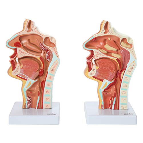 Axis Scientific Human Larynx and Pharynx Disorders Model | Shows Normal Larynx and Pharynx Anatomy and Details Common Abnormalities | Comes on White Base