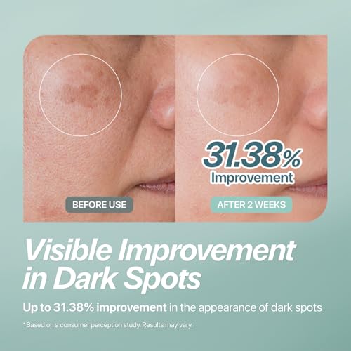 CHARDE Peel Off Cream Mask for Dark Spots, Cream-to-Clear Mask for Brighter, More Even-Looking Skin, At-Home Care Routine (50ml) - Image 4