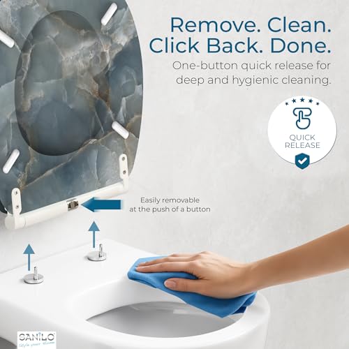 Image of Sanilo Wooden Toilet Seat with Quick Release & Soft Close [ROUND] - Decorative & Slow Close Molded Wood Seat - With One Click for Easy Installation & Cleaning - With Adjustable Fit (Marble Italia)