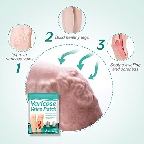 EMUKOEP Adesivos de perna de aranha para varizes, varizes, vasculite e flebite, 8 peças (1)