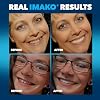 Imako Premium Cosmetic Uppers for Men and Women Temporary Smile Makeover - 2 Pack - Large, Bleached White - Made in USA