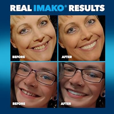 Imako Premium Cosmetic Uppers for Men and Women Temporary Smile Makeover - 2 Pack - Large, Bleached White - Made in USA