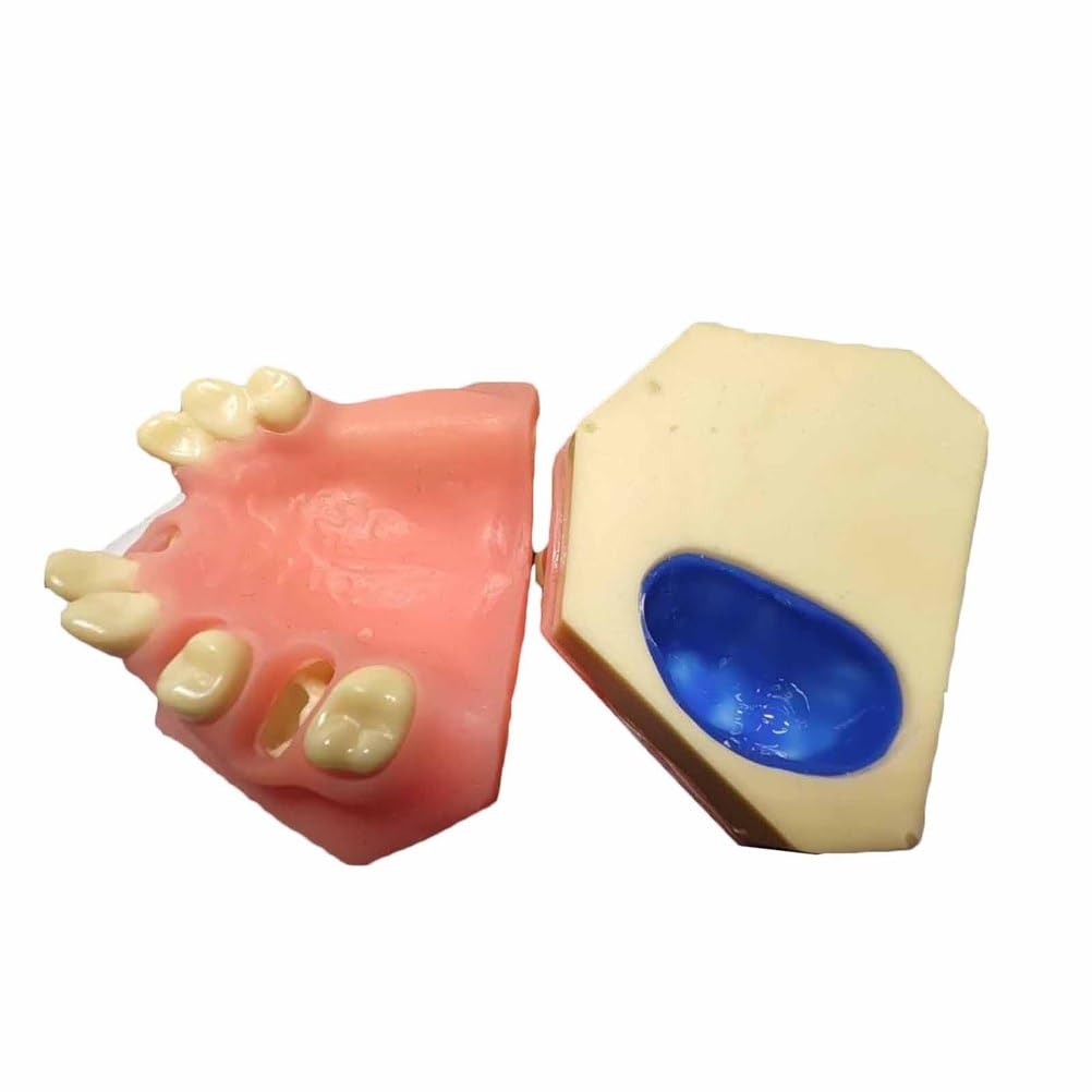 Modèle d'Implant Dentaire Modèle d'Implant Dentaire pour Formation, Enseignement, Démonstration et Étude