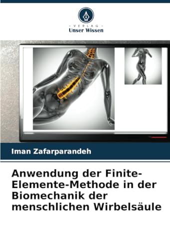 Anwendung der Finite-Elemente-Methode in der Biomechanik der menschlichen Wirbelsäule (German Edition)