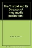 The thyroid and its diseases