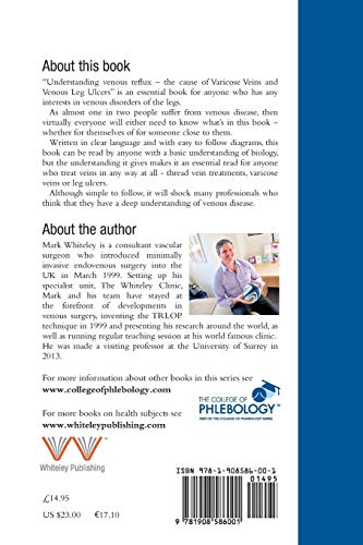 Understanding Venous Reflux the Cause of Varicose Veins and Venous Leg Ulcers: Varicose veins and ve