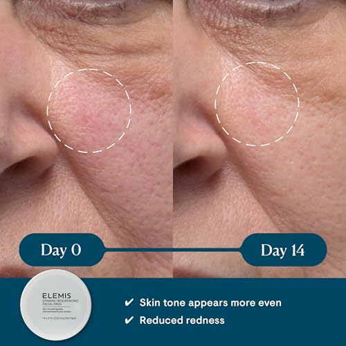 ELEMIS Dynamic Resurfacing Facial Pads, Gentle Textured Treatment Facial Exfoliating Pads - Image 3