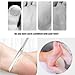 Stainless steel ingrown toenail pedicure knife set,professional foot skin scraper repair sharp blade kit for nail corn callus paronychia treatment. (3)